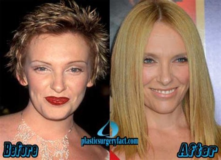 Actress Toni Collette Weight Loss Transformation- Before And After Photos Exposed