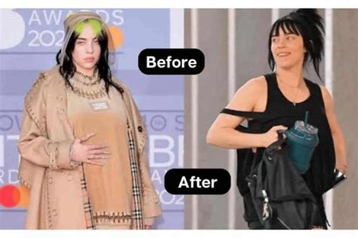 Billie Eilish Weight Loss Transformation: Here Are Before And After Pictures