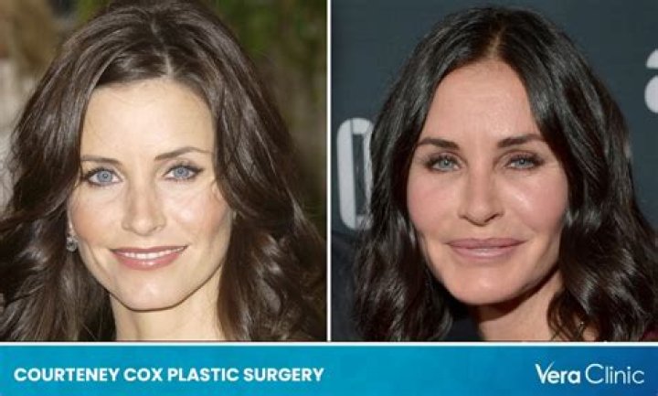 
Courteney Cox Regretting Her Plastic Surgery Looks Now Opting For More Natural Tones By Dissolving All Her Fillers 