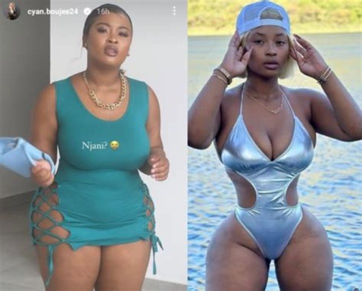 
Cyan Boujee Before Surgery Pictures: What Did She Do? Boyfriend And Net Worth 
