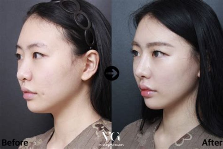 
Gangnam Plastic Surgery Clinic IP Cam Video Leaked Went Viral 