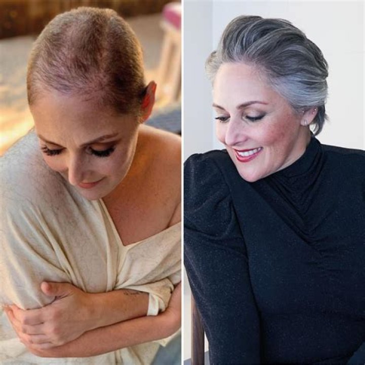
Ricki Lake Shares Stunning Before and After Photos Amid Hair Loss Battle 