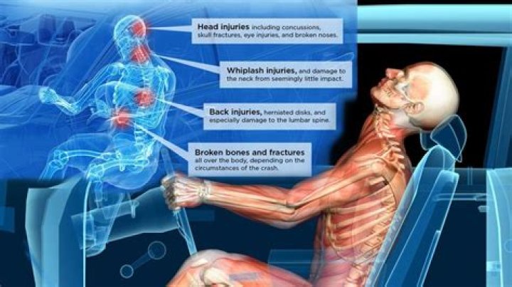 
What Happened To Anne Heche? Does She Have Mental Illness? Injury After Accident And Arrested Facts Explained 