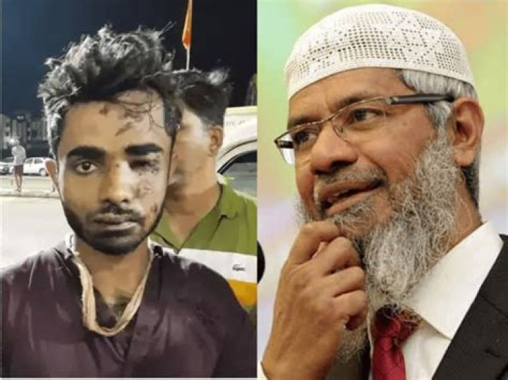 
Zakir Naik Controversy: Accused Of Money Laundering And Hate Speech 